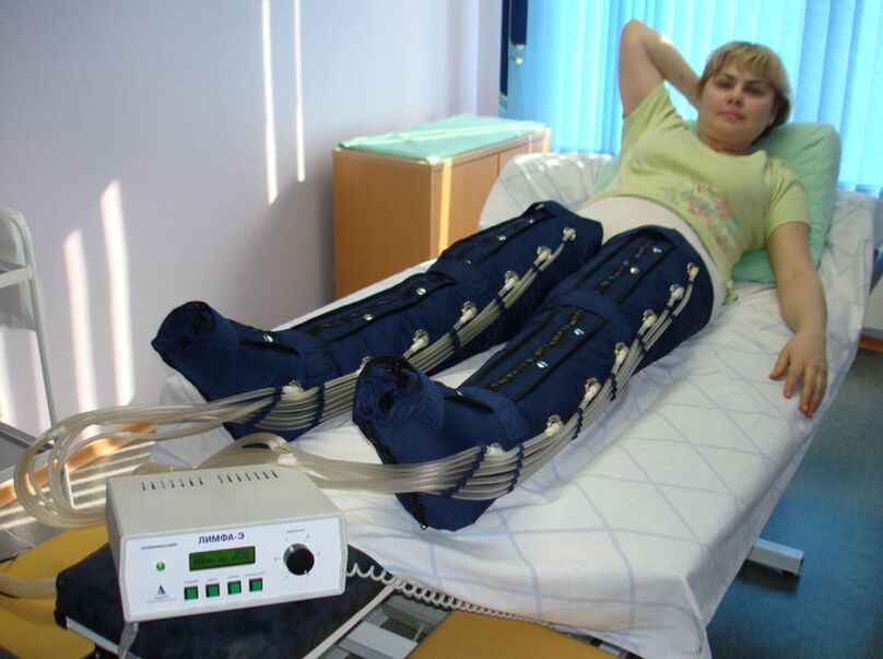 Terapia de compresión para las venas varicosas en las piernas.